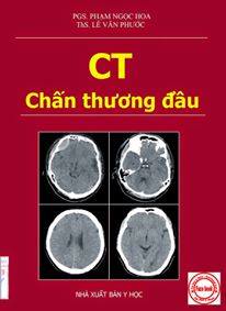 Chấn thương đầu